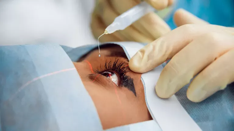 Donate a Cataract Surgery (Adult)